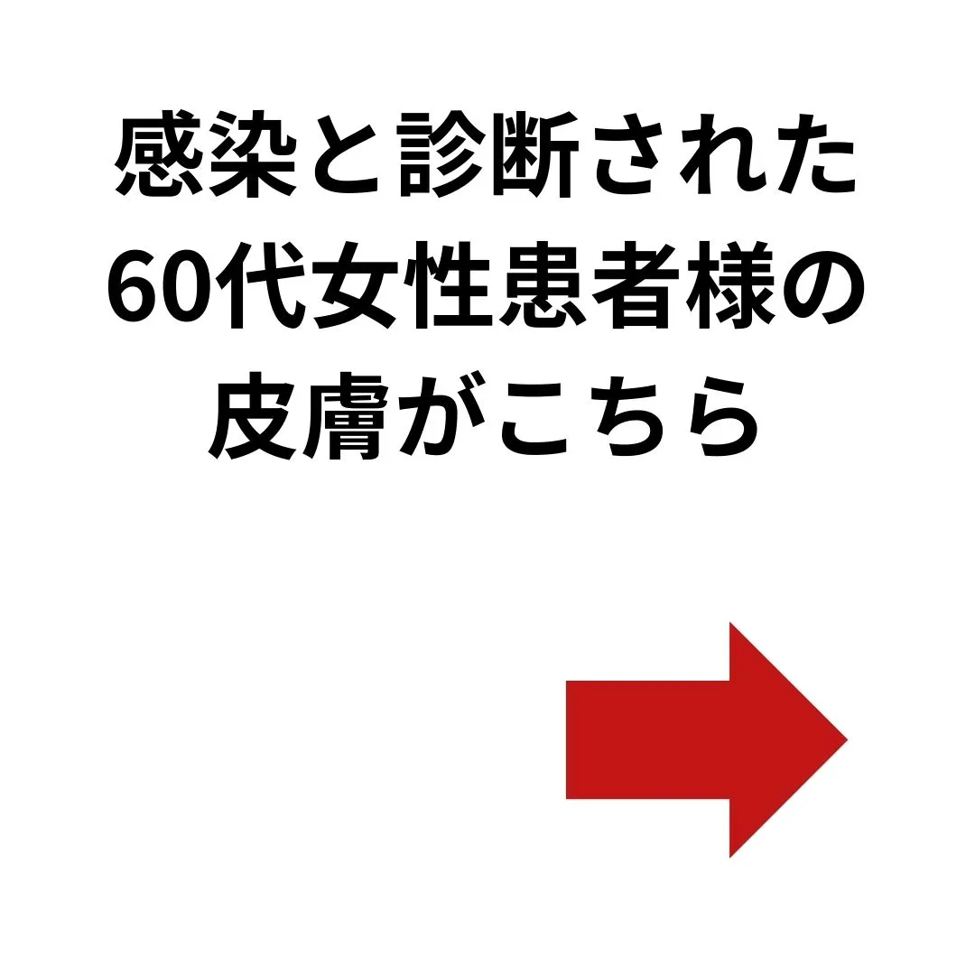 【鶴橋のポキポキしないカイロ整体 S.K.カイロワールド】