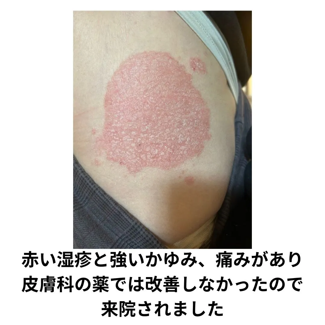 【鶴橋のポキポキしないカイロ整体 S.K.カイロワールド】