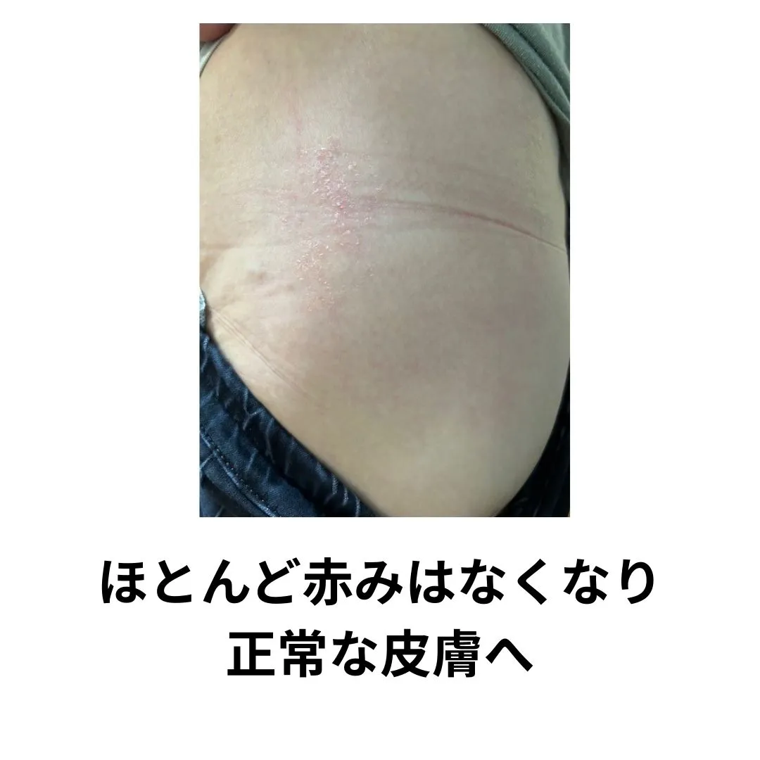 【鶴橋のポキポキしないカイロ整体 S.K.カイロワールド】